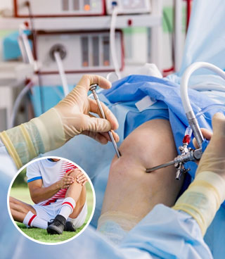 Arthroscopy & Sports Injuries