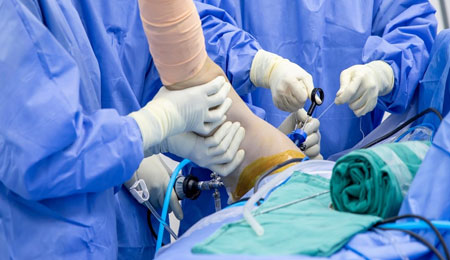 Shoulder Arthroscopy Surgery